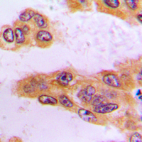 Rabbit anti-BCKDK Polyclonal Antibody