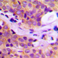Rabbit anti-PLC γ2 Polyclonal Antibody