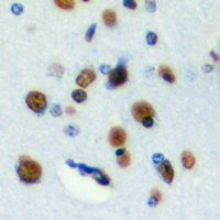 Rabbit anti-RFWD3 Polyclonal Antibody