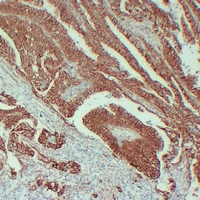 Mouse anti-β-Catenin Monoclonal Antibody