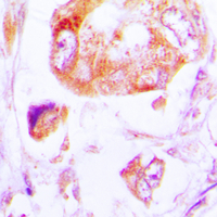 Rabbit anti-CK1α Polyclonal Antibody