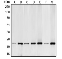 Rabbit anti-BIM Polyclonal Antibody