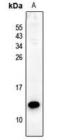 Rabbit anti-PS2 Polyclonal Antibody