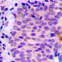 Rabbit anti-ATG4C Polyclonal Antibody