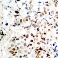Rabbit anti-CTIP Polyclonal Antibody