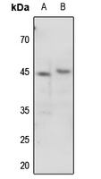 Rabbit anti-Phospho-p47 Phox(Ser345) Polyclonal Antibody