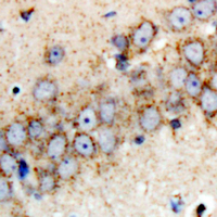 Rabbit anti-Parkin Polyclonal Antibody