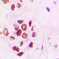 Rabbit anti-PIAS3 Polyclonal Antibody