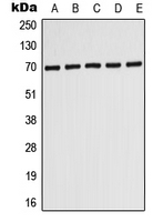 Rabbit anti-ABCD3 Polyclonal Antibody