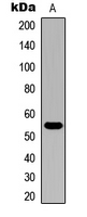 Rabbit anti-Cytochrome P450 21A2 Polyclonal Antibody