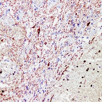 Mouse anti-NEFL Monoclonal Antibody