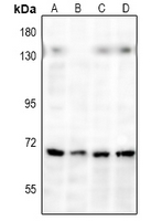 Rabbit anti-NF-kappaB p65 Polyclonal Antibody