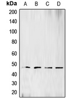 Rabbit anti-BCKDK Polyclonal Antibody
