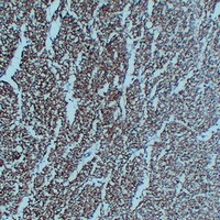 Mouse anti-NEFL Monoclonal Antibody