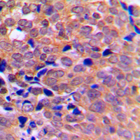Rabbit anti-AMPK α1/2 Polyclonal Antibody