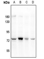 Rabbit anti-PARP3 Polyclonal Antibody