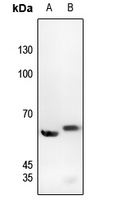 Rabbit anti-Phospho-c-SRC(Tyr529) Polyclonal Antibody