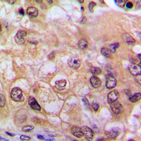 Rabbit anti-NF-kappaB p65 Polyclonal Antibody