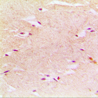 Rabbit anti-PEX14 Polyclonal Antibody