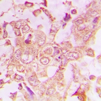 Rabbit anti-Collagen 10α1 Polyclonal Antibody