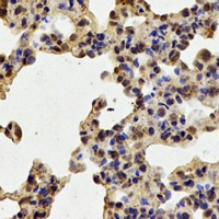Rabbit anti-TPP2 Polyclonal Antibody