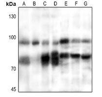 Rabbit anti-PFKM Polyclonal Antibody