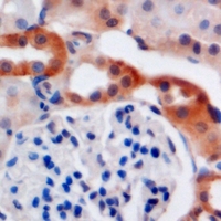 Rabbit anti-C4BP β Polyclonal Antibody