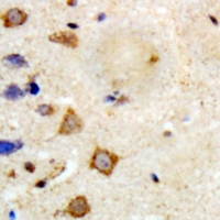 Rabbit anti-TRAF6 Polyclonal Antibody