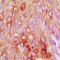 Rabbit anti-Serpin B5 Polyclonal Antibody