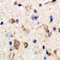 Rabbit anti-GABRB2 Polyclonal Antibody