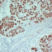 Mouse anti-Claudin 4 Monoclonal Antibody