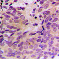 Rabbit anti-CERKL Polyclonal Antibody