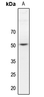 Rabbit anti-Dematin Polyclonal Antibody