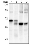 Rabbit anti-CD127 Polyclonal Antibody
