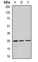 Rabbit anti-C4BP β Polyclonal Antibody