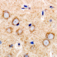 Rabbit anti-TGFBR2 Polyclonal Antibody