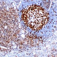 Mouse anti-CD279 Monoclonal Antibody