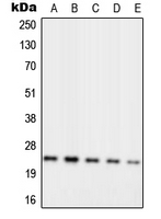 Rabbit anti-RPL10 Polyclonal Antibody