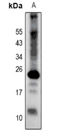 Rabbit anti-Claudin 2 Polyclonal Antibody