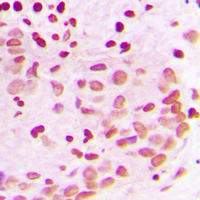 Rabbit anti-PML Polyclonal Antibody