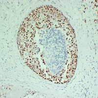 Mouse anti-Estrogen Receptor α Monoclonal Antibody