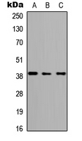 Rabbit anti-ABHD4 Polyclonal Antibody