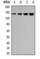 Rabbit anti-TPP2 Polyclonal Antibody