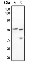 Rabbit anti-CstF-50 Polyclonal Antibody