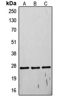 Rabbit anti-TIMP4 Polyclonal Antibody