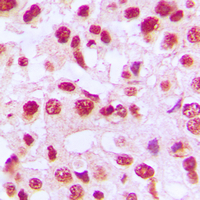 Rabbit anti-c-Rel Polyclonal Antibody