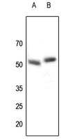 Rabbit anti-Parkin Polyclonal Antibody