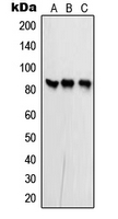 Rabbit anti-PFKP Polyclonal Antibody