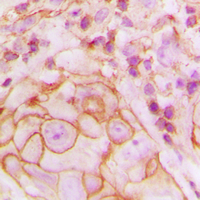 Rabbit anti-GPR105 Polyclonal Antibody