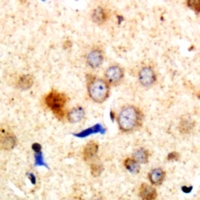 Rabbit anti-Dematin Polyclonal Antibody